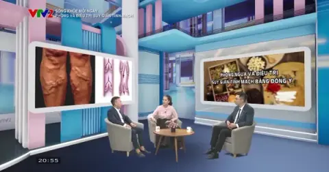 Ảnh xem trước video phòng và điều trị suy giãn tĩnh mạch trên VTV